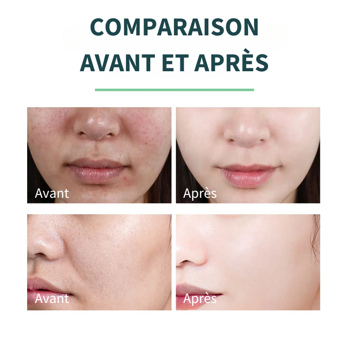 Gel exfoliant - Revelis™